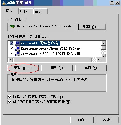 Windows XP 网络连接的属性